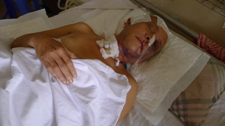 Người đàn ông nằm viện với hồ sơ bệnh án "vô danh" - 3 Hàng ngày nằm trong phòng bệnh, người đàn ông này vẫn chờ người trong gia đình đến thăm