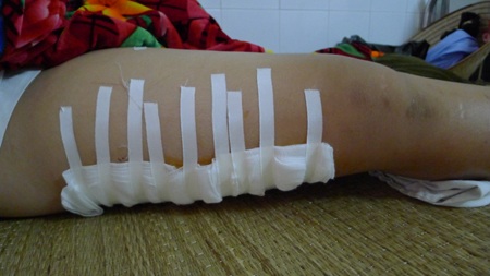 Nằm ở viện, Trường cứ băn khoăn sao bà không gọi điện cho mẹ để em nói chuyện