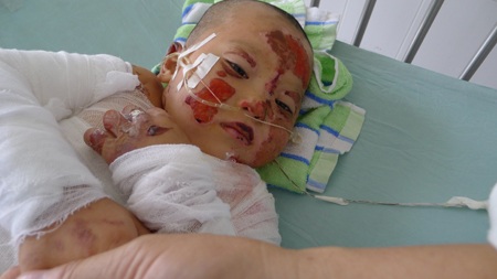 Khuôn mặt loang lổ những vết thương nhưng tuyệt nhiên Quyết không khóc