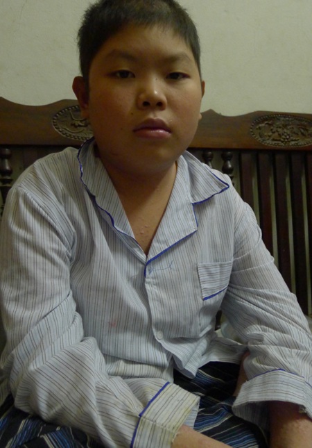 Bị bệnh vảy nến thể mủ nên cậu bé Hoàng thường xuyên phải đến viện chữa trị