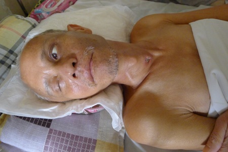 Mặc dù tình trạng sức khỏe đã khá hơn, tuy nhiên bác Thang vẫn chưa thể nhận biết được điều gì