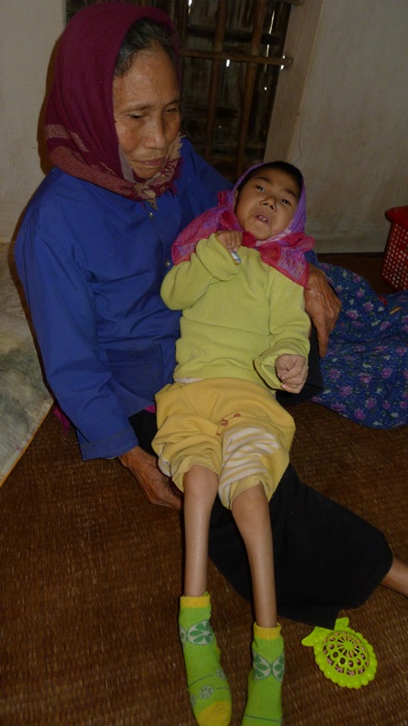 8 năm bé Hồng vẫn như một đứa trẻ sơ sinh chỉ biết nằm cả ngày 