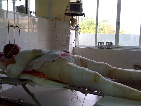 Chị muốn được trở về với hai con để nuôi dạy chúng, nhưng nỗi lo vì không có tiền điều trị tiếp