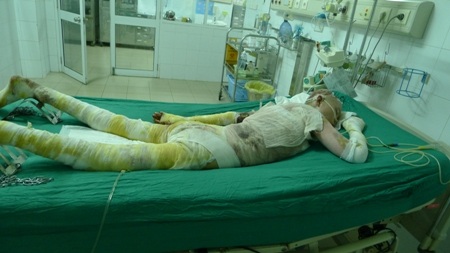 Hiện tại tình trạng của chị Nga vẫn hết sức nguy kịch