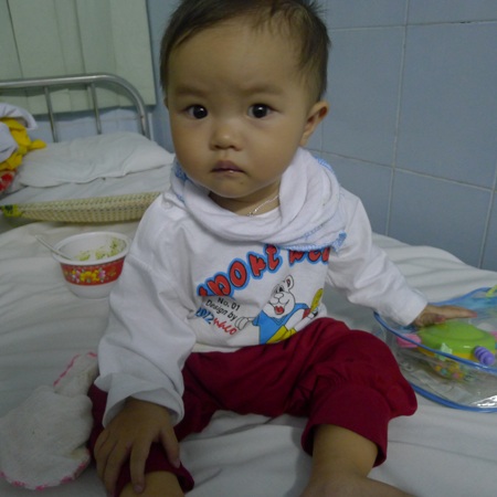 Thứ 2 tuần tới bé Ly sẽ bước vào ca phẫu thuật 