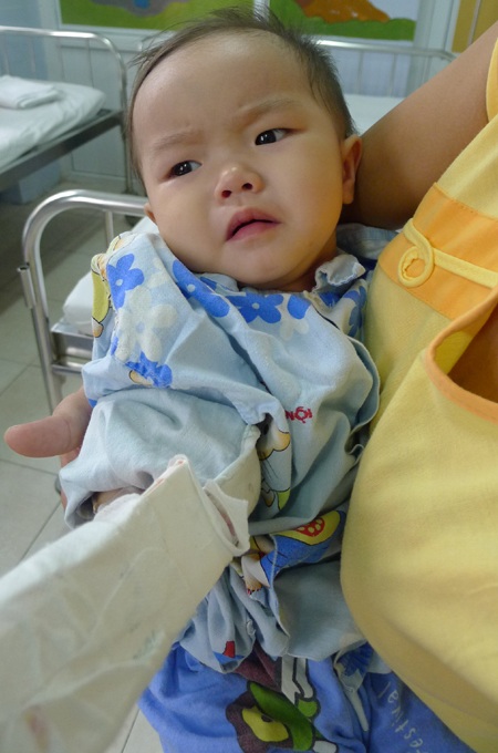 Sau ca mổ, đôi môi của bé Ly đã hồng hào trở lại