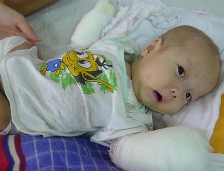 Ánh mắt ngây thơ của bé Tùng tại khoa truyền nhiễm của bệnh viện Nhi TW