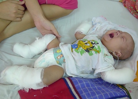 Tiếng khóc ngằn ngặt của em vì phải chịu đựng những cơn đau hành hạ