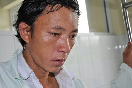 Tai nạn bỏng xăng khiến cho cơ thể bé Phủ bị tổn thương nghiêm trọng 