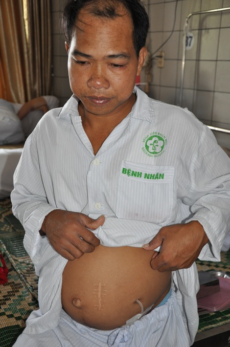 Không có người thân bên cạnh chăm sóc, một mình anh Tráng chống chọi với bệnh tật.