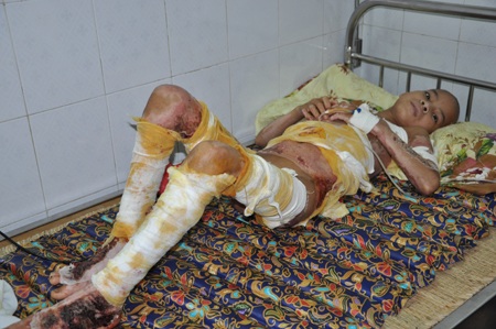 Phủ cho biết em rất vui vì có nhiều mẹ đến tận bệnh viện thăm em.