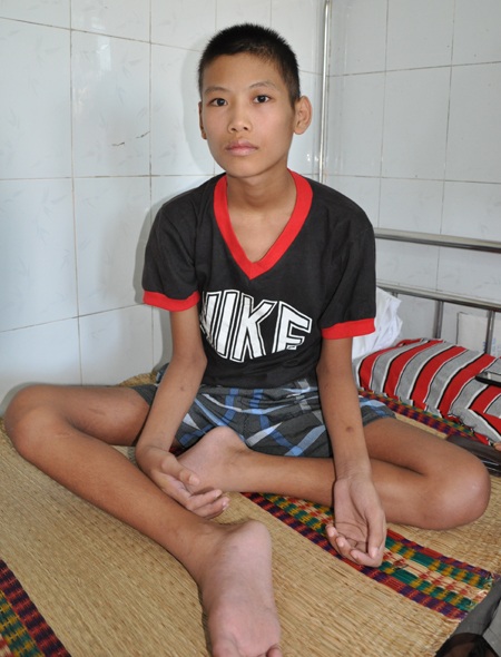 Mặc dù tình trạng đã khá hơn nhưng chân tay cậu bé Đoàn chưa cử động được.