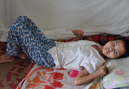 Mắc chứng bệnh Wilson đã 2 năm nay khiến cơ thể cô bé Hương trở nên co quắp.