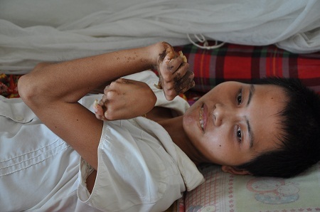 Tay của em dị dạng không bình thường.