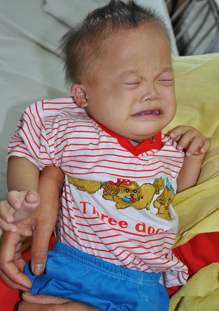 Căn bệnh tim thể phức tạp, khiến cậu bé Toản quấy khóc cả ngày.