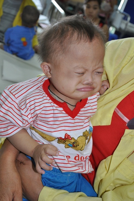 Em bé dân tộc Dáy đang trong tình trạng nguy kịch