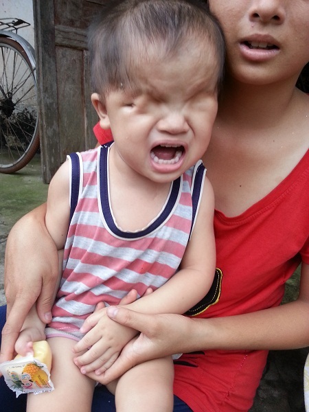 Lại thêm một bé 2 tuổi đáng thương khiếm khuyết... "cửa sổ tâm hồn" - 6 Bản thân bé Phượng (14 tuổi) là chị lớn đã phải nghỉ học 3 năm nay để phụ giúp gia đình.