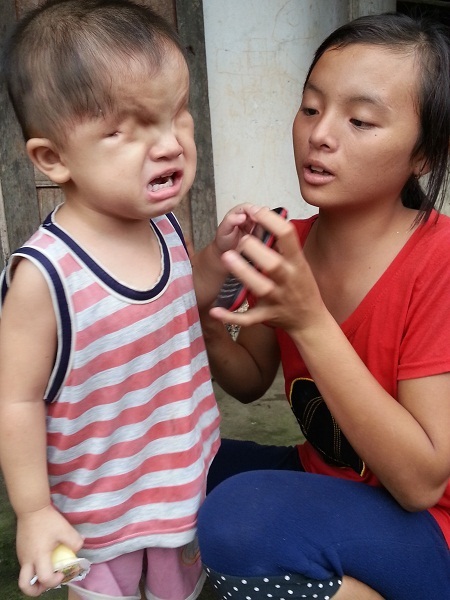 Lại thêm một bé 2 tuổi đáng thương khiếm khuyết... "cửa sổ tâm hồn" - 2 Em sợ hãi khóc thét lên mỗi khi chiếc điện thoại hết pin không còn hát được nữa.