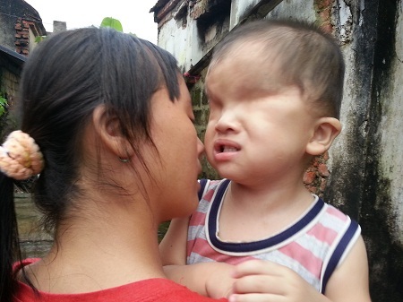 Lại thêm một bé 2 tuổi đáng thương khiếm khuyết... "cửa sổ tâm hồn" - 5 Bản thân bé Phượng (14 tuổi) là chị lớn đã phải nghỉ học 3 năm nay để phụ giúp gia đình.