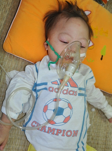 Bé Thương đang được làm xét nghiệm để kết luận bệnh tim và down bẩm sinh