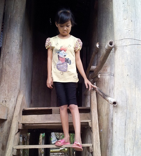 Cô bé lớp 8 sống dựa vào cụ nội... 103 tuổi - 4 Cuộc sống khó khăn lại ở miền núi nên cô bé Ngân không có điều kiện đến viện chữa bệnh.