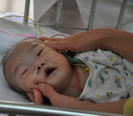 Mỗi lần ăn, em đều phải nhờ bác sĩ đặt ống xông và mẹ phải giữ để sữa không trào ra.