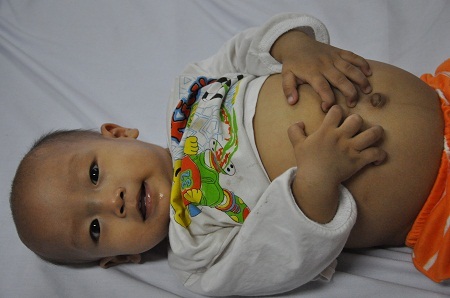 Mắc căn bệnh ung thư dạng hiếm gặp buộc em phải được ghép tủy mới cứu được tính mạng.