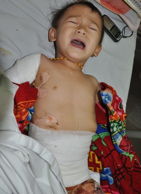 Những cơn đau liên tục khiến em khóc lặng cả người.