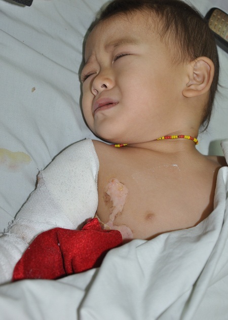 Mỗi lần lên cơn đói, bé Sao thường quấy khóc vì không có sữa uống.