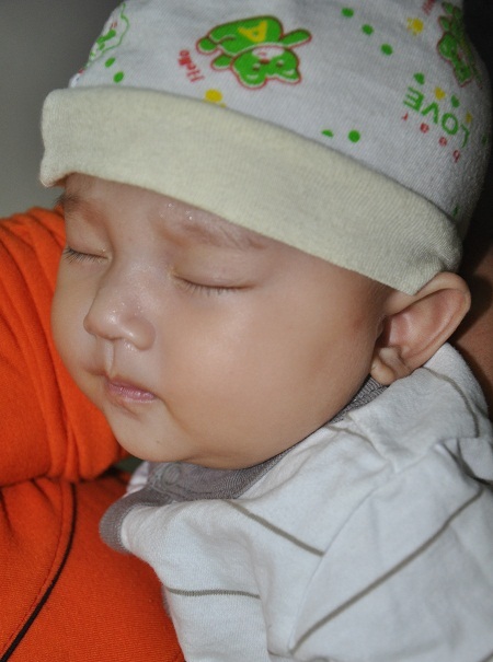 Em bé Hà Phương được bạn đọc Dân trí đủ tiền cho ca mổ.