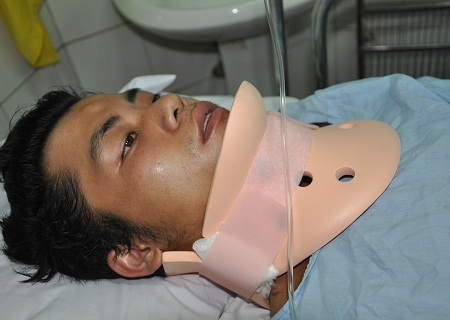 Bị ngã từ nhà sàn xuống khiến Mơ chấn thương ở vùng cổ và liệt tủy.