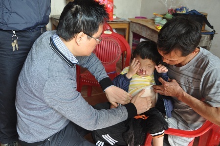 Tự được các bác sĩ khoa Phẫu thuật tạo hình của bệnh viện Nhi TW khám bệnh tại nhà.