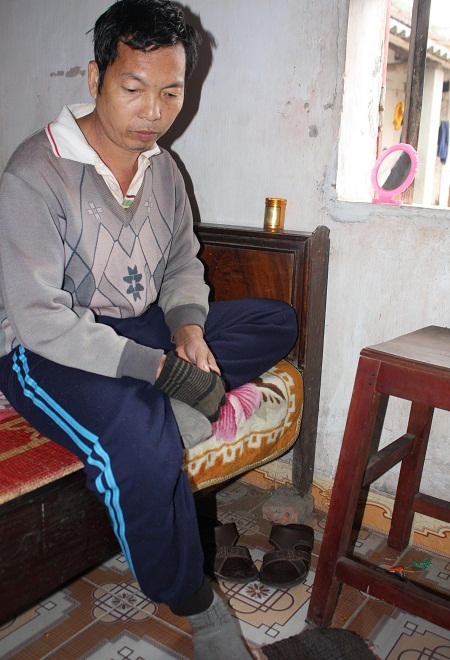 "Ngày tết, chúng tôi chỉ biết ôm nhau mà khóc" - 5 Bị tai biến nên anh Giảng cũng bị liệt nửa người bên phải đã 2 năm nay.