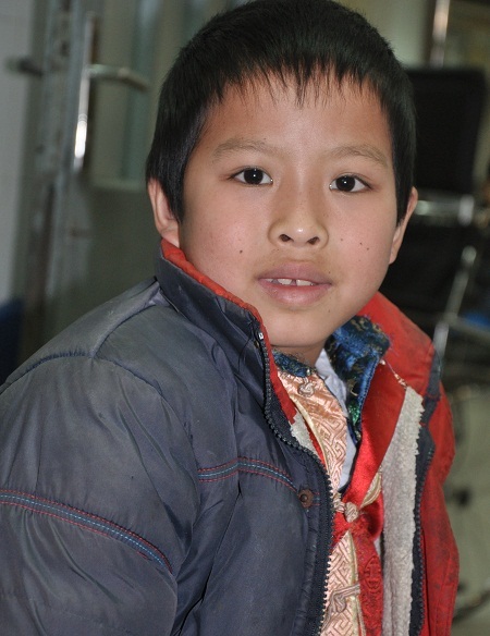 Gương mặt tươi tắn của cậu bé Lý Bình Minh sau ca phẫu thuật.