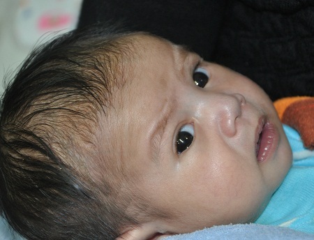 Căn bệnh tim của Nhật được bác sĩ cho biết ít nhất em phải phẫu thuật đến 2 lần mới cải thiện được.