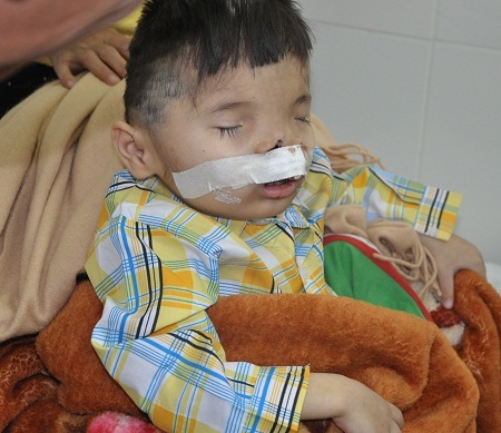 Cậu bé có khuôn mặt kì dị đã được xuất viện về nhà