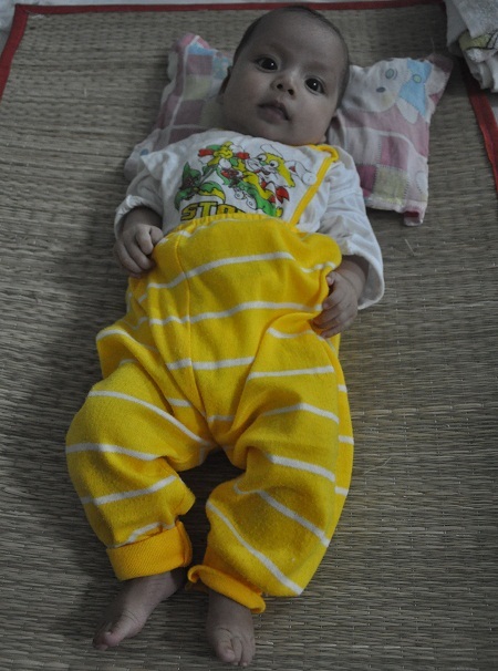 Cô bé có đôi mắt biết cười truyền cho mọi người niềm tin em sẽ vượt qua căn bệnh nguy hiểm.