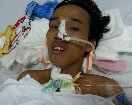 Tình cảnh khốn khó của người đàn ông liệt tứ chi vì tai nạn ngã xe máy