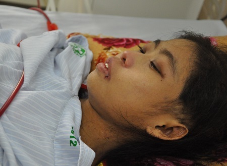 Khiến cơ thể trở nên tong teo, tiều tụy.