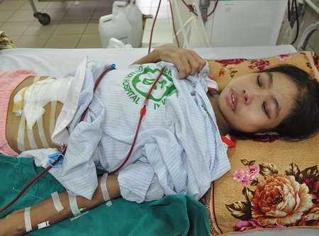 Khiến cơ thể trở nên tong teo, tiều tụy.