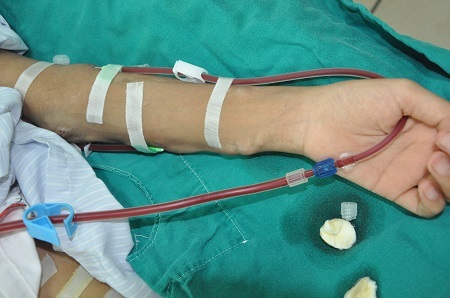 Căn bệnh đủ sức bào mòn cơ thể em...