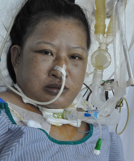 Chị cần phải mổ gấp với chi phí lên đến 100 triệu đồng để cứu tính mạng.