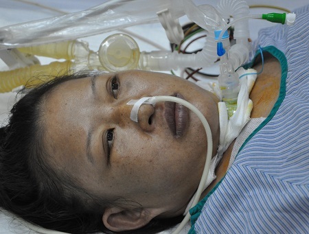 Không có tiền phẫu thuật, chị Nhị đứng trước nguy cơ bỏ lại 3 đứa con thơ.