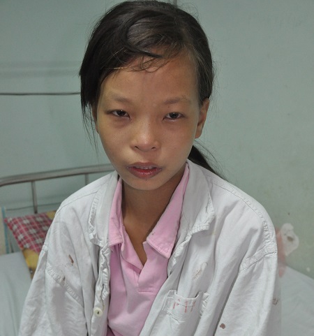 14 tuổi, cô bé Huế đứng trước nguy cơ mất mạng vì không có tiền mổ tim.