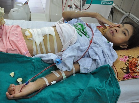 Mắc chứng bệnh Lupus, cô bé Hoa đã không qua khỏi.