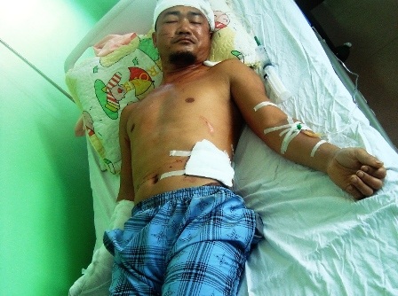 Nhóm côn đồ hung hãn xông vào nhà dân chém người - 2