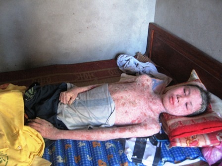 Trao quà nhân ái tới em Phạm Văn Ngân    - 1