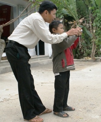 Phó nháy khiếm thị “độc nhất vô nhị” - 3