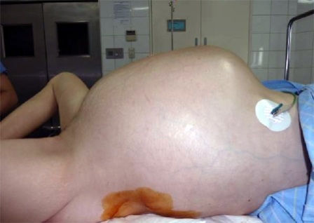 Bệnh nhân trước khi được phẫu thuật.