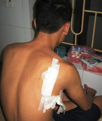 Anh Dương phải nhập viện với nhiều vết thương trên cơ thể.